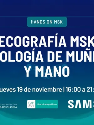 Image of: Hands on: Patología de muñeca y mano - Ecografía MSK