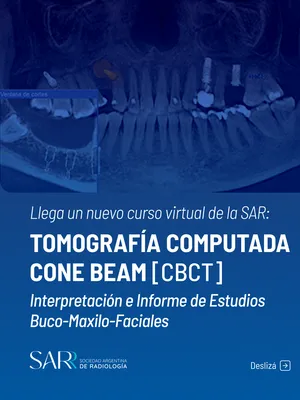 Image of: Tomografía Computada Cone Beam: Interpretación e Informe de Estudios Buco-Maxilo-Facial