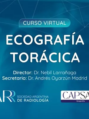 Image of: Ecografía toraxica